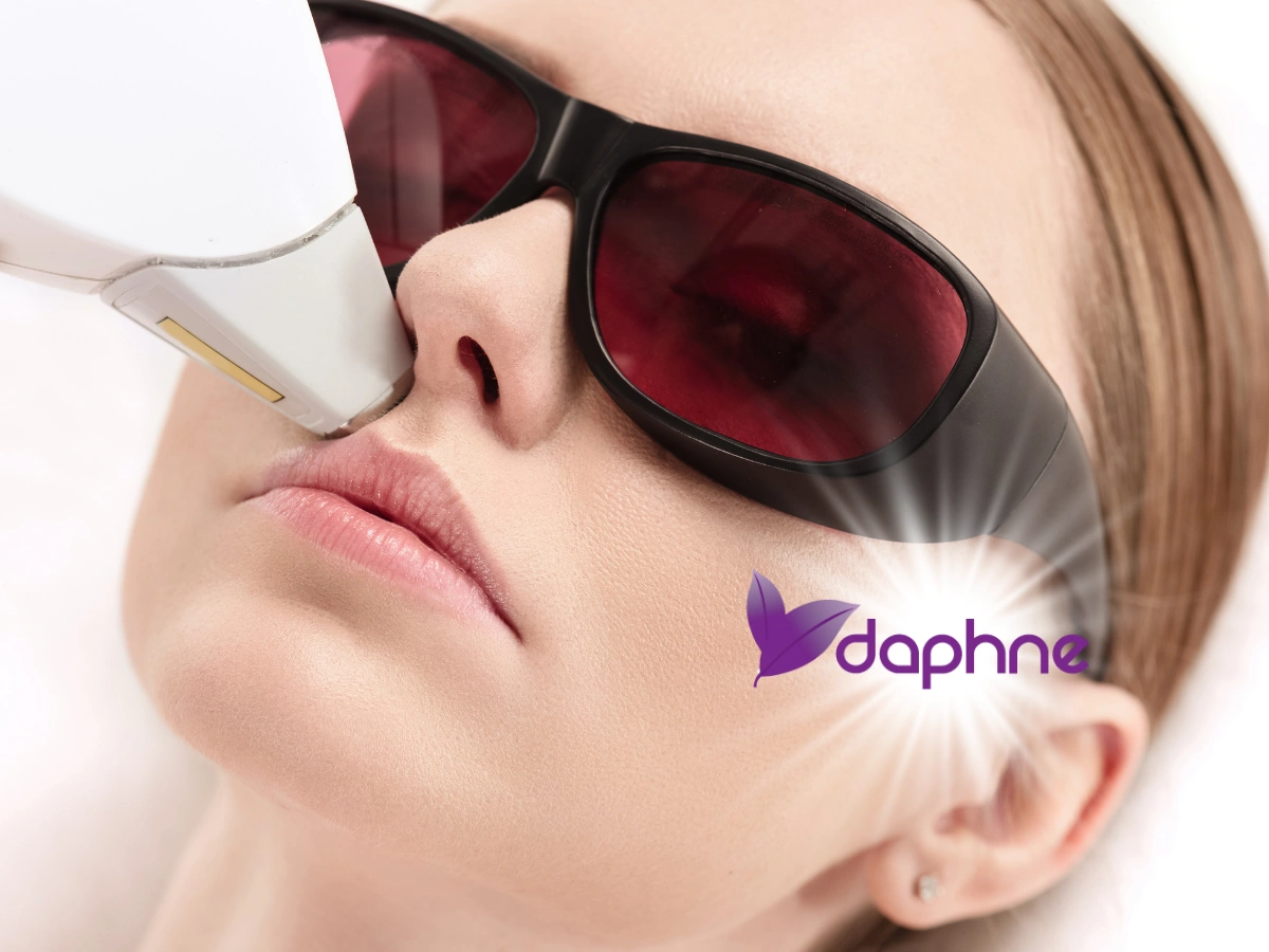 Diode lazer epilasyon sırasında yüz bölgesinde soğutmalı uygulama başlığı