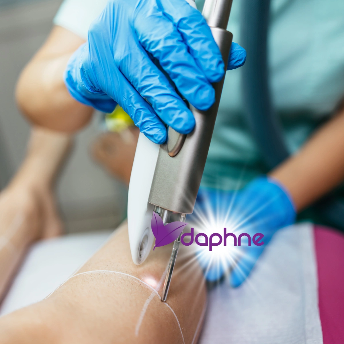 Lazer nedir, lazer ışığı, dalga boyu, medikal lazer ve estetik dermatolojide lazer prensipleri